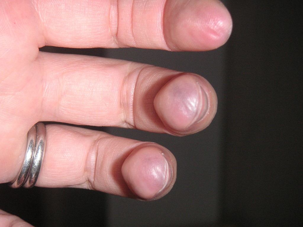 guitar fingers